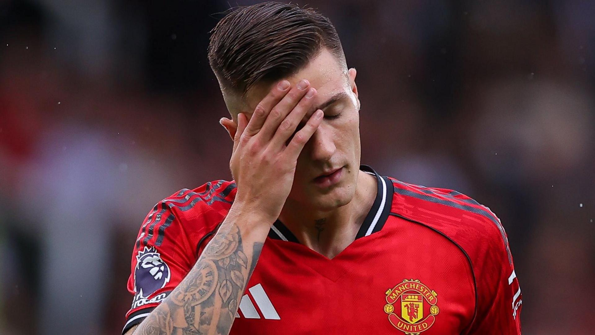 Man Utd striker Sesko out for about a month with knee injury